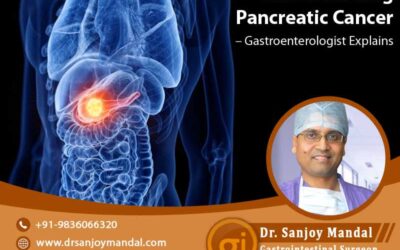 Understanding Pancreatic Cancer – Gastroenterologist Explains