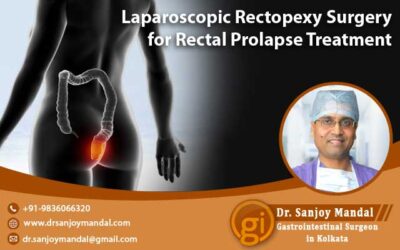 Laparoscopic Rectopexy Surgery for Rectal Prolapse Treatment