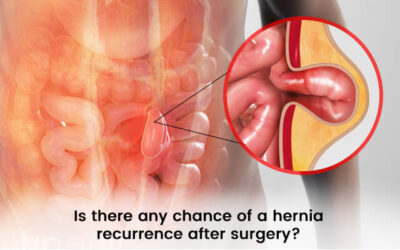 Hernia recurrence after surgery