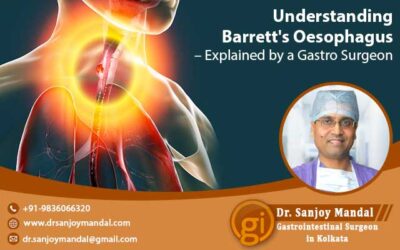 Understanding Barrett’s Oesophagus – Explained by a Gastro Surgeon