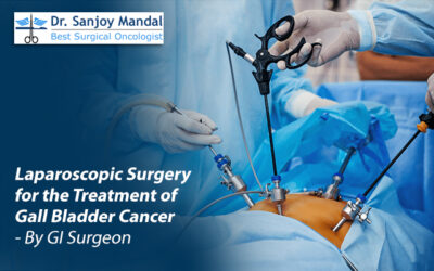 Laparoscopic Surgery for the Treatment of Gall Bladder Cancer- By GI Surgeon