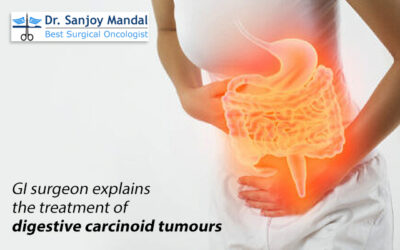 GI surgeon explains the treatment of digestive carcinoid tumours