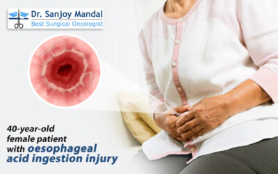 40-year-old female patient with oesophageal acid ingestion injury