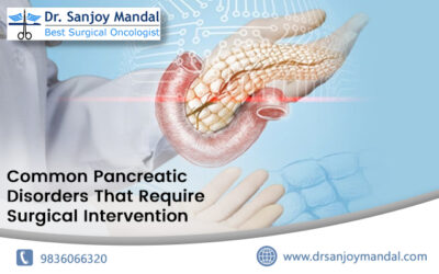 Common Pancreatic Disorders That Require Surgical Intervention
