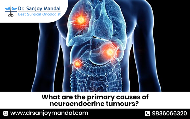 What are the primary causes of neuroendocrine tumours?