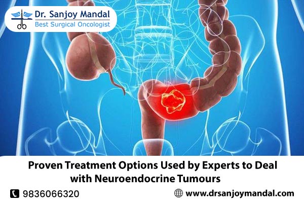 Proven Treatment Options Used by Experts to Deal with Neuroendocrine Tumours