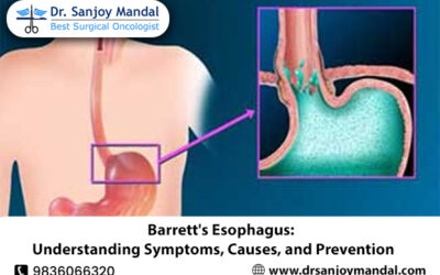 Barrett’s Esophagus: Understanding Symptoms, Causes, and Prevention