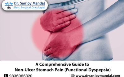 A Comprehensive Guide to Non-Ulcer Stomach Pain (Functional Dyspepsia)