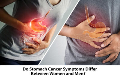 Do Stomach Cancer Symptoms Differ Between Women and Men?