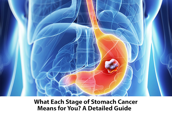 stomach cancer stages