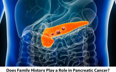 Does Family History Play a Role in Pancreatic Cancer?