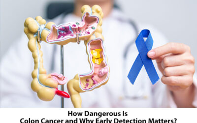 How Dangerous Is Colon Cancer and Why Early Detection Matters?