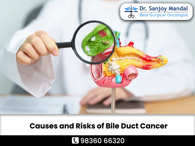 Causes and Risks of Bile Duct Cancer