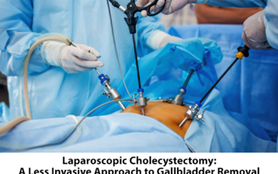 Laparoscopic Cholecystectomy: A Less Invasive Approach to Gallbladder Removal