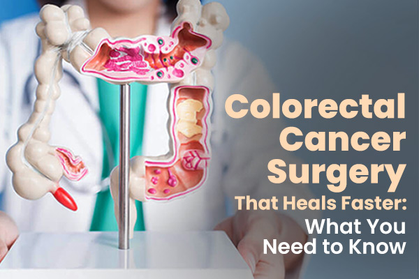 Colorectal Cancer Surgery That Heals Faster: What You Need to Know